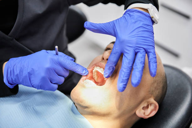 Best Emergency Tooth Extraction in Nashvle, IL